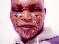 Bright0100 avatar