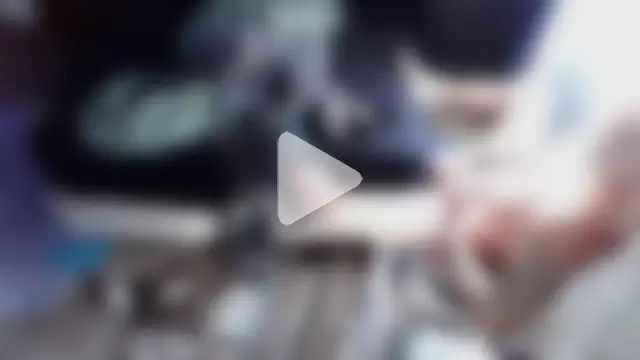 EdgarAlenPole photo 18