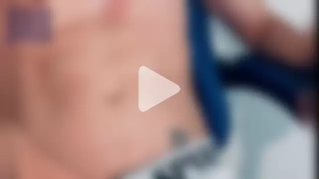 Hot_teo1 photo 17
