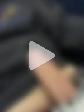 Prolapse_Pig photo 18