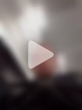 openlegsforyou photo 25