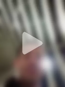 openlegsforyou photo 13