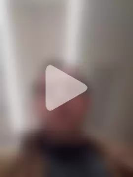 openlegsforyou photo 10