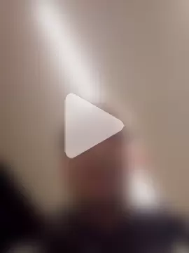 openlegsforyou photo 5