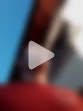 openlegsforyou photo 3