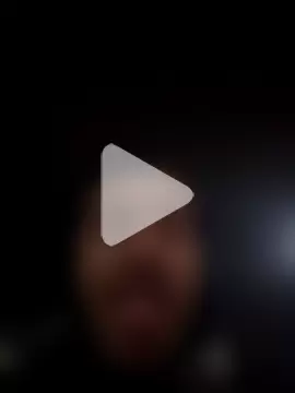 openlegsforyou photo 21