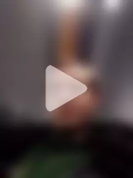 openlegsforyou photo 11