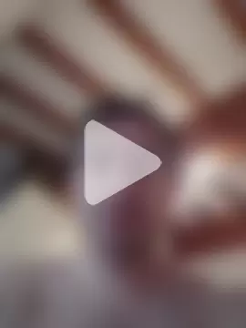 openlegsforyou photo 6