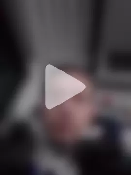 openlegsforyou photo 20