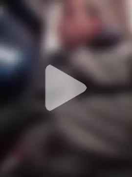 openlegsforyou photo 17