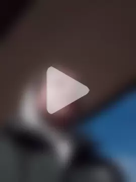 openlegsforyou photo 15