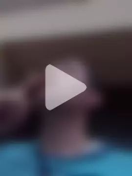 openlegsforyou photo 22