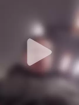 openlegsforyou photo 21