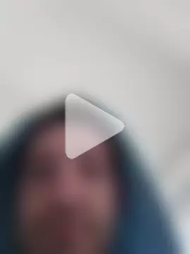 openlegsforyou photo 17