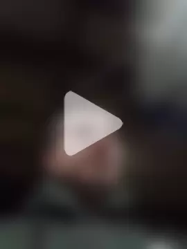 openlegsforyou photo 14