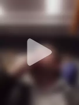 openlegsforyou photo 12