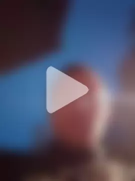 openlegsforyou photo 9