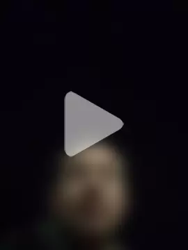 openlegsforyou photo 6