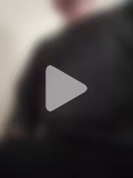 openlegsforyou photo 2