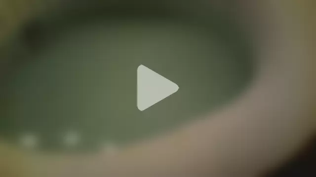 theSecretBallerino photo 21